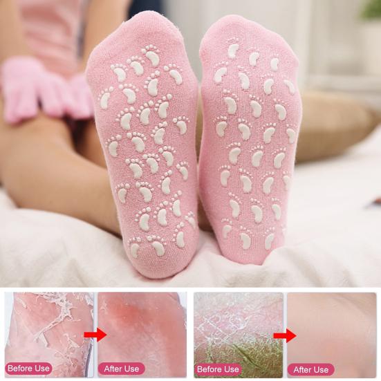 Silicone Gel Heel Pad Socks For Pain Relief And Anti Crack - 1 Pair - Image 9